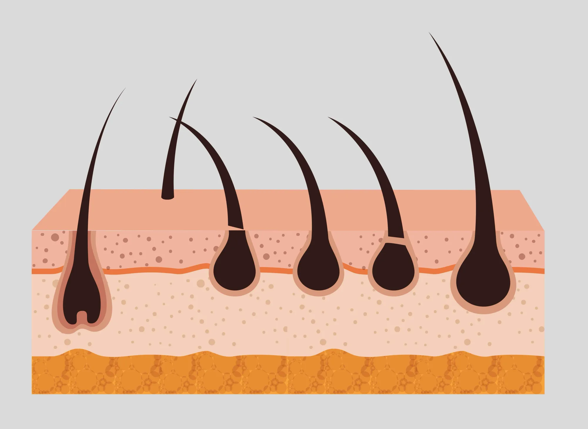 Como usar minoxidil na barba e obter resultados